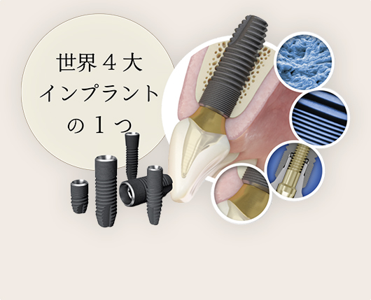 安全性と効果を追求した歴史あるインプラントシステムを導入