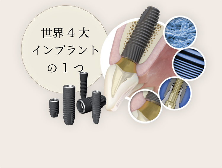 安全性と効果を追求した歴史あるインプラントシステムを導入