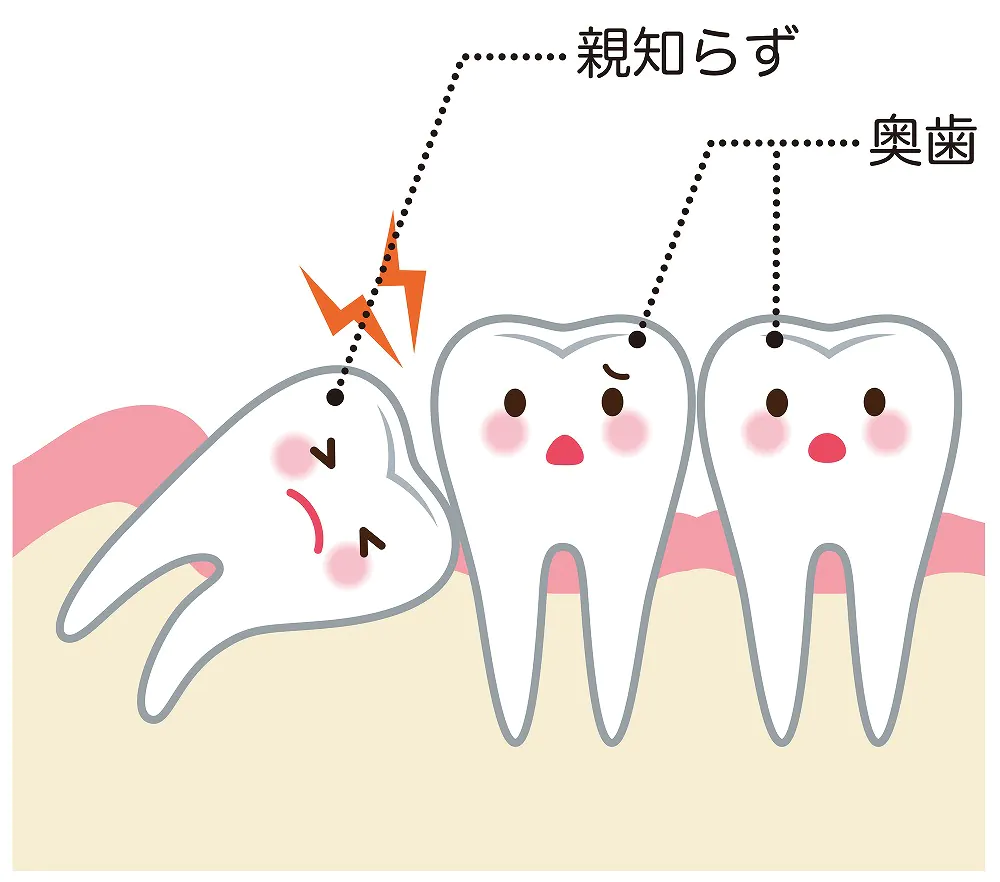 親知らず